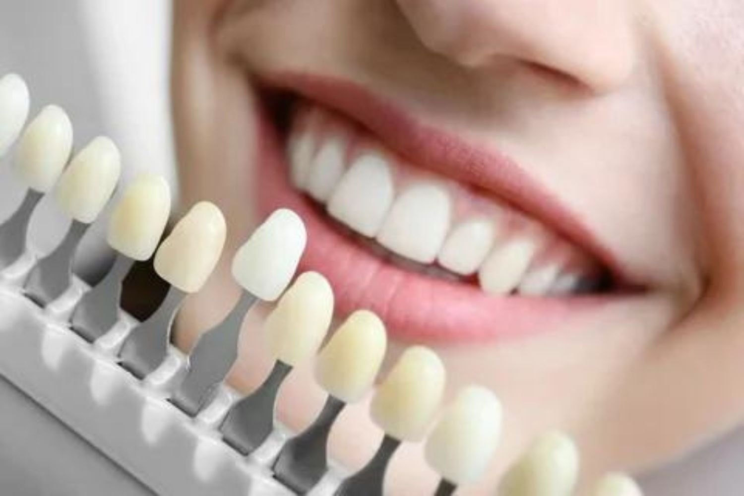 Dental Services- Venners