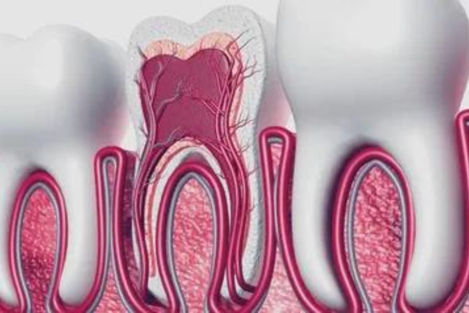 Dental Services- Root Canal Treatment